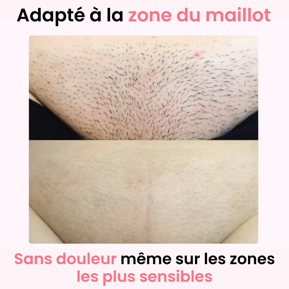 Epilatore luce pulsata IPL - Ulvessa Lite