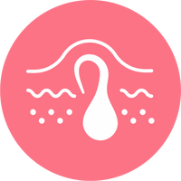 Niente più peli incarniti